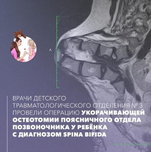 Картинка Операция.jpg